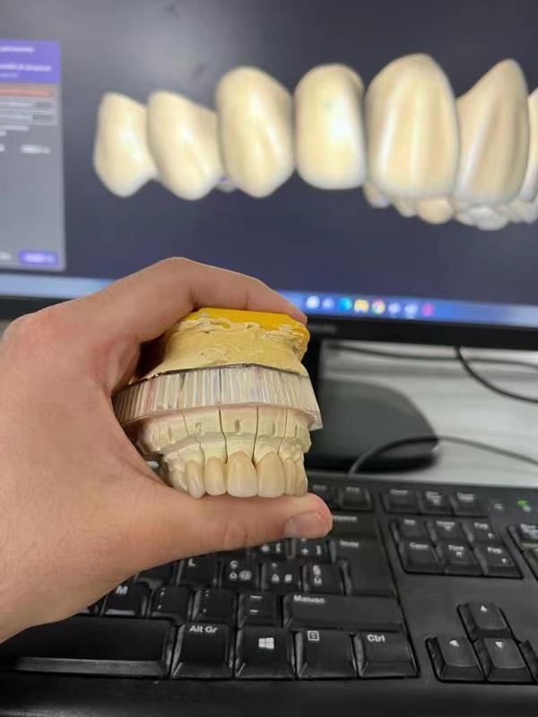 Pour Yucera 4D Pro Zircone Dentaire Bloc Disque Couronne Bridge CADCAM Disque pour Laboratoire Dentaire Fabriqué à partir de Bois Résine Machines Source d'alimentation