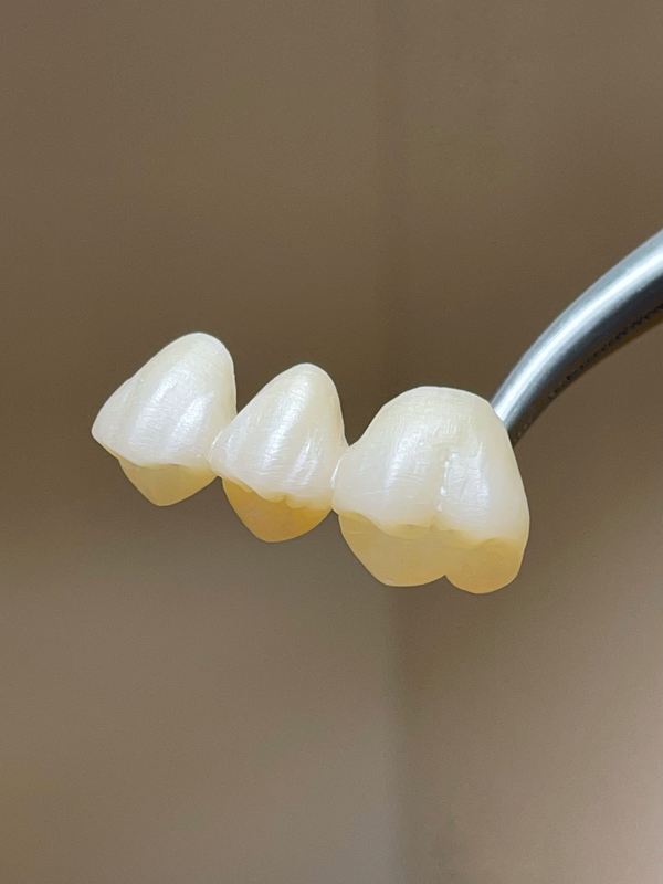 Dental Lab CAD CAM Super Translucent Zirconia Block Dioxide Zirconium Disc Beautiful Porcelain Aesthetics 10-25mm Sizes