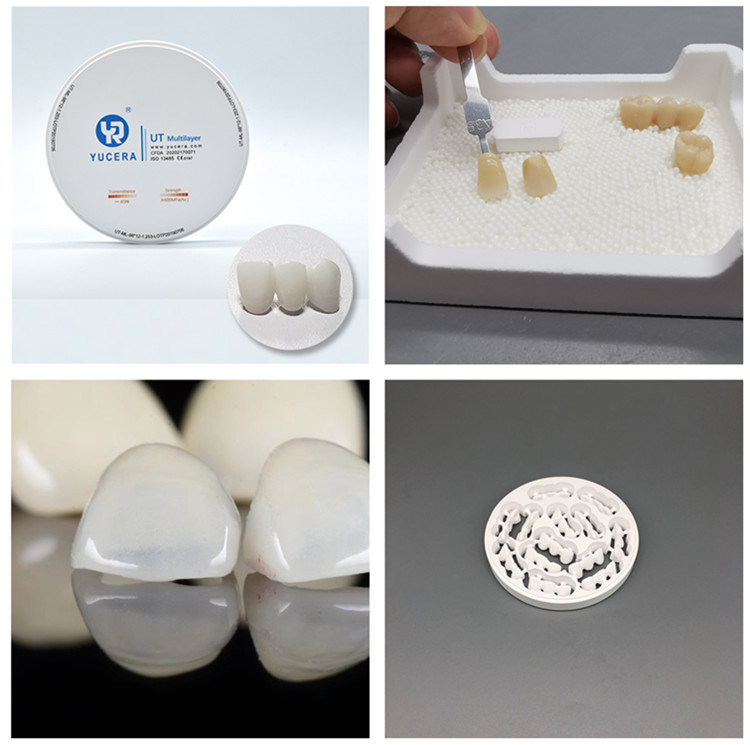 YUCERA Dental Zirconia Blocks 98mm  UT  for  Dental Veneers Teeth