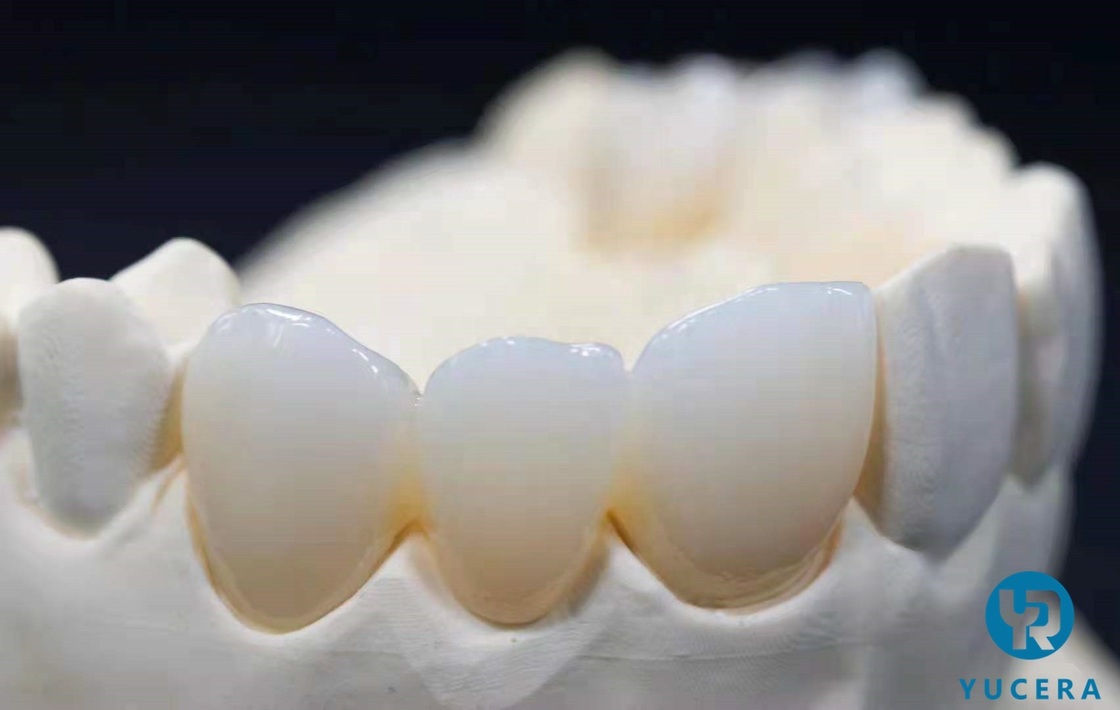 Yucera Dental Multilayer SHT Zirconia Ceramic Block Open System 98mm for Dental Cad Cam
