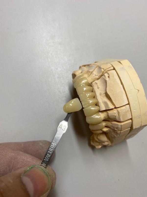 Dental Lab Cad Cam Materials Zirconia Blocks 16mm 3D Multilayer Pre Shaded Zirconia Dental Block for Open System Milling Machine