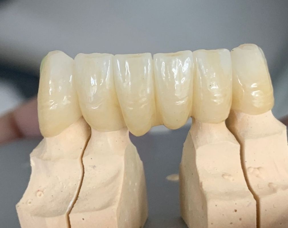 3D Plus Multilayer 43% -57% 6 Layers Dental Block Disc for CAD CAM Crown and Bridge 98mm Open System