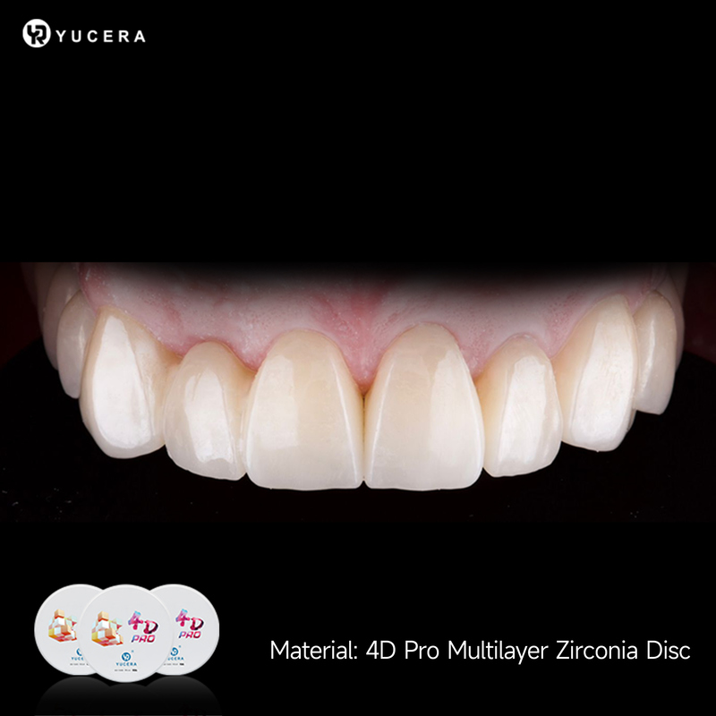 Yucera High Translucent 98mm Zirconia Disc for Dental Crown and Bridge with 1200MPa Strength Lab Grade