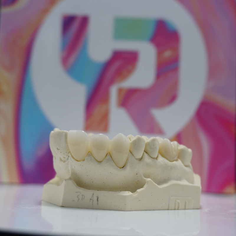 YUCERA 4D PRO Multilayer Zirconia Block Customized  Dental Cad Cam Dental Laboratory Multi-layered Zirconia Block