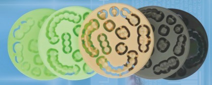 Disque PMMA de haute qualité Yucera avec service OEM Matériaux dentaires pour laboratoire dentaire