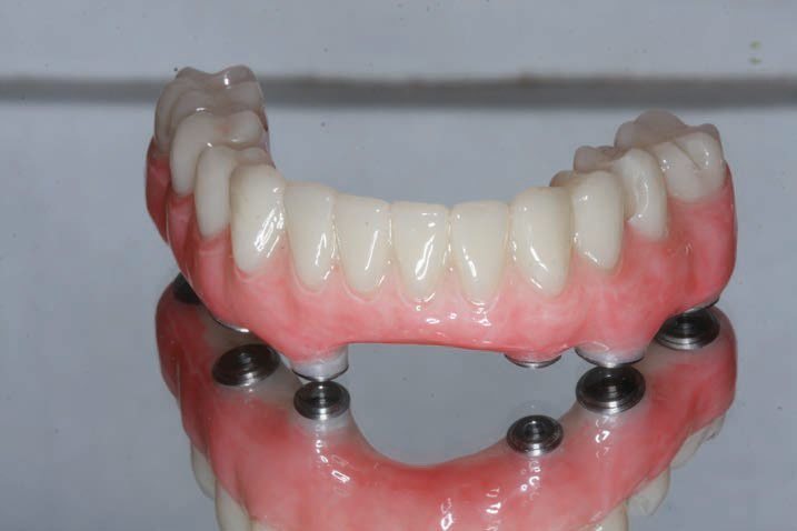 Disque Multi PMMA CAD CAM Yucera Cad Cam Matériau Dentaire PMMA Blocs Disque de Zircone Dentaire Blocs de Résine PMMA Flexibles