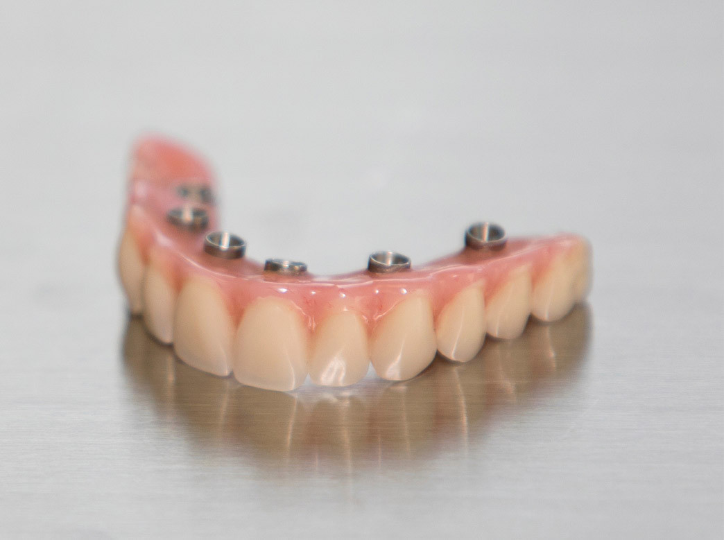 Yucera  Blocs de PMMA monocouche pour fraisage dentaire CAD/CAM, résine acrylique acétal pour prothèses dentaires