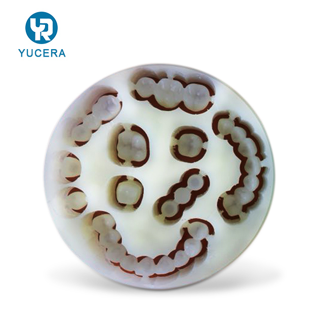 PMMA monocouche dentaire Yucera Optimal Transparency pour des prothèses précises et d'apparence naturelle