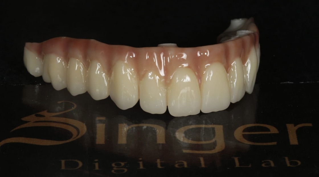 Bloc céramique en zircone spécifique Yucera 4D Pro Dental avec la technologie HT Plus améliorant la qualité des restaurations