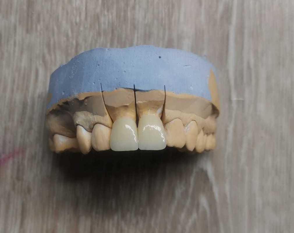 Disques de zircone dentaire couleur ST Yucera parfaitement assortis à nos blocs de haute qualité