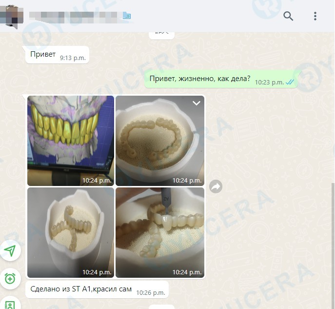 Bloc de zircone dentaire multicouche 3D haute précision Yucera 4D Pro - Stable et fiable, créant des résultats de restauration idéaux