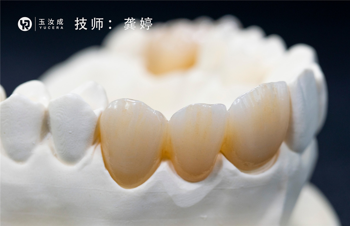 Yucera 3D plus le système ouvert du bloc 98x16mm de zircone de Multilaer pour la couronne postérieure